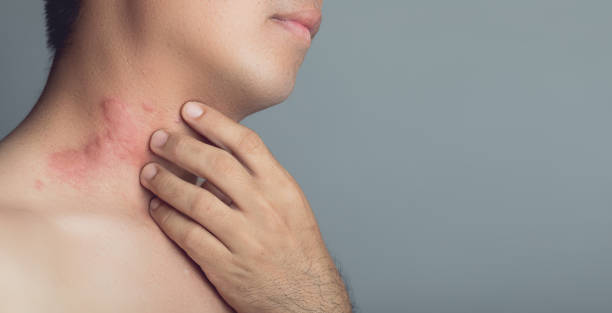 Skin itching, rashes and irritation